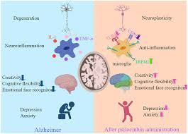 Case report links psilocybin mushrooms to temporary gains in advanced Alzheimer’s patient