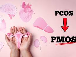 پس از سال‌ها بحث بر سر نام گمراه‌کننده، PCOS به PMOS تغییر نام داد