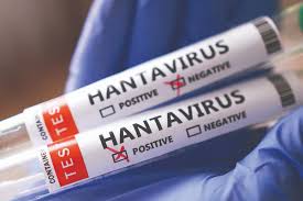 Pourquoi les autorités disent que le hantavirus n'est pas un autre COVID-19