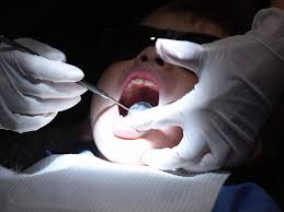 Anciens patients d’un dentiste de Sydney invités à se faire dépister pour le VIH et l’hépatite